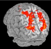 Brain scans show activation of the parietal lobe when a subject was &quot;driving&quot; undistracted, left, and during conversation.