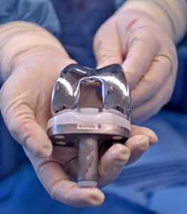 Robert E. Booth Jr. with an artificial knee during surgery at Pennsylvania Hospital. Booth says he performs about 1,200 knee replacements a year.