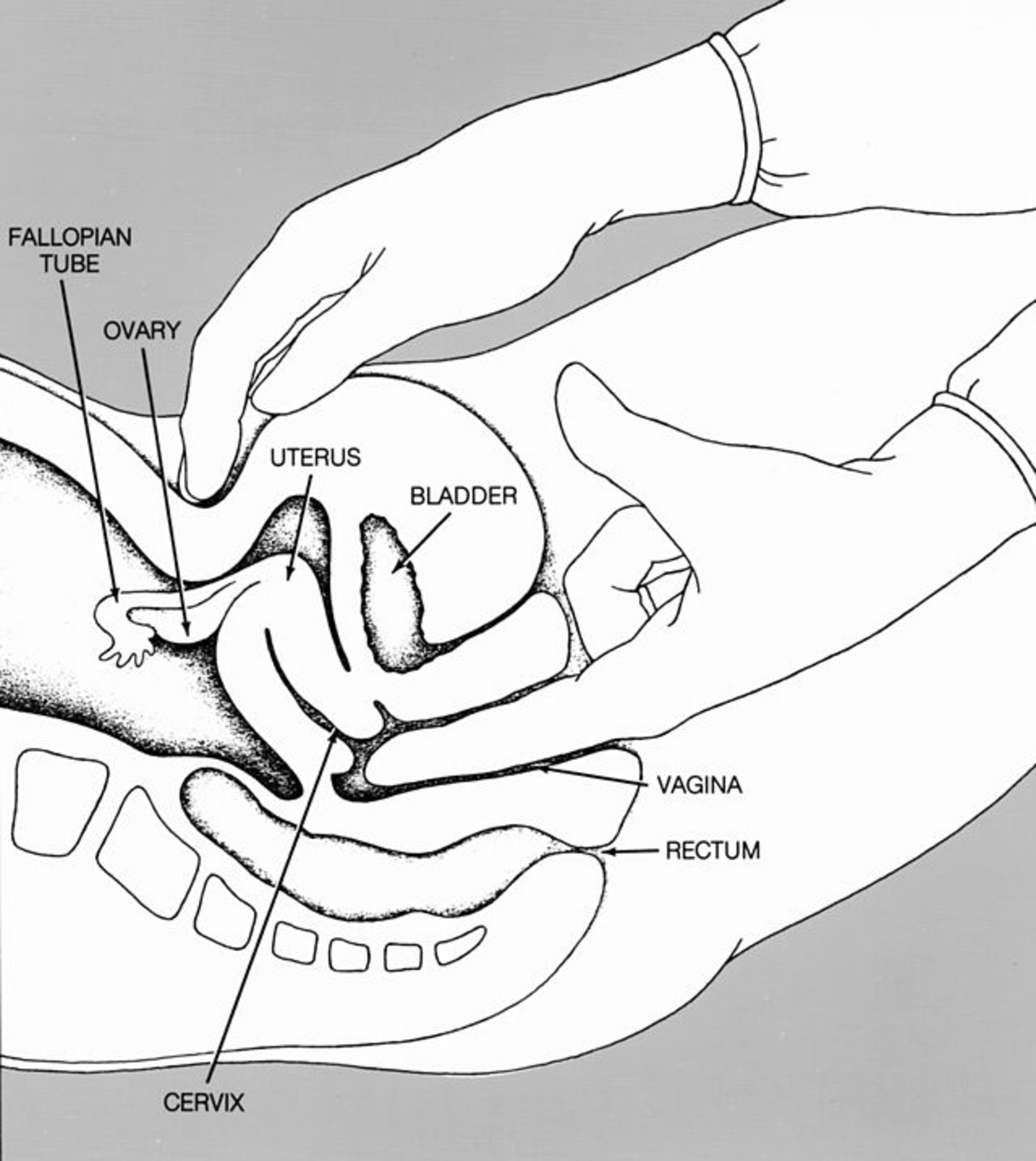 Confusion About The Pelvic Exam Philly