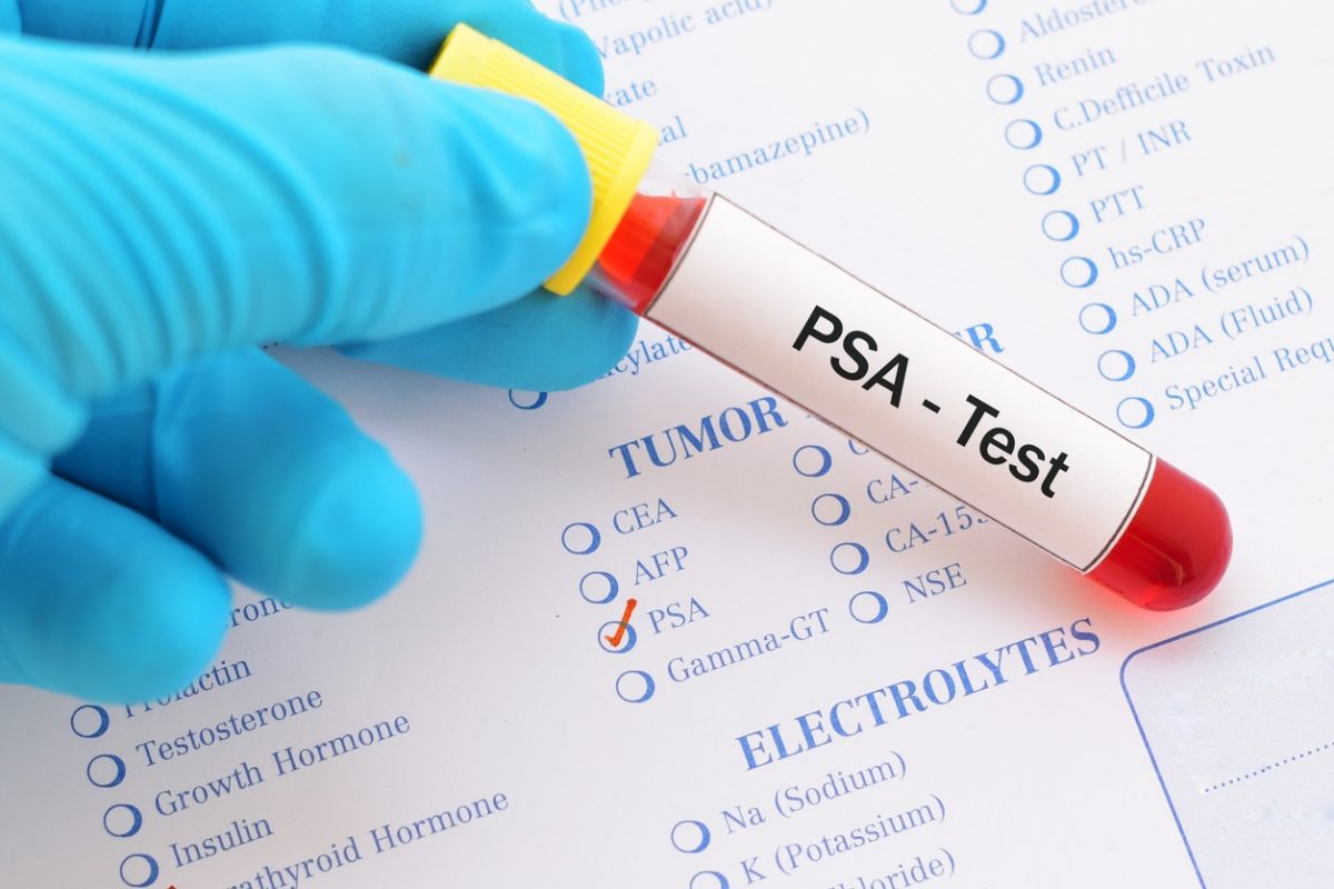  What Do Cancer Antigen Numbers Mean B Cells B Lymphocytes The 