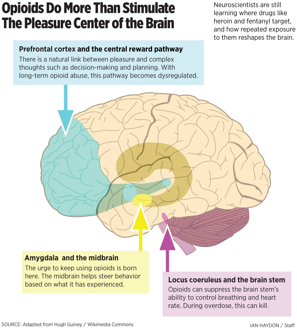 How Opioids Reshape Your Brain, And What Scientists Are Learning About ...