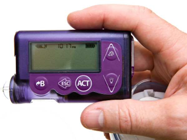 non-invasive-no-lag-continuous-glucose-monitor-starting-clinical-trials