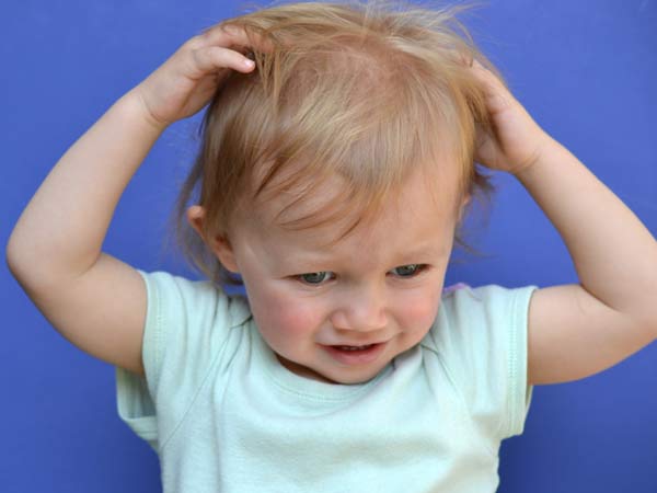 Why the rash, hair loss, irritability in a 4-month-old?